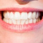 Carol Stream IL Dentist | The Dangers of Grinding